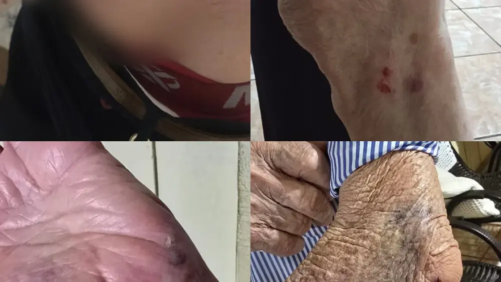 Idoso de 87 anos é atacado por cachorro em Campo Grande