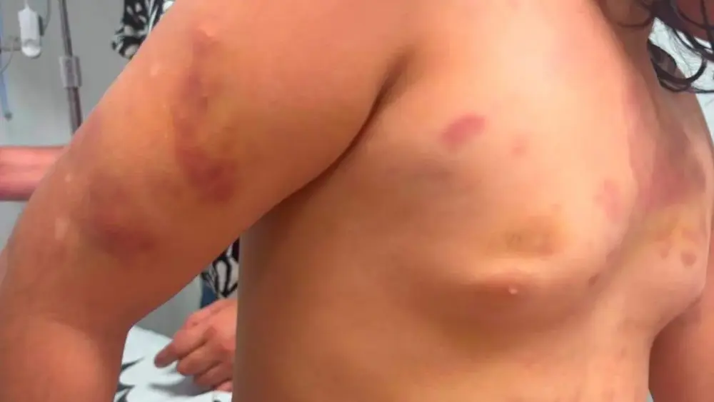 Padrasto é preso por agredir menina autista de 6 anos em MS